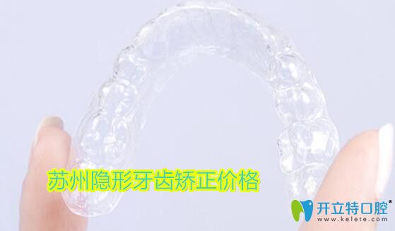 蘇州隱形牙齒矯正價格