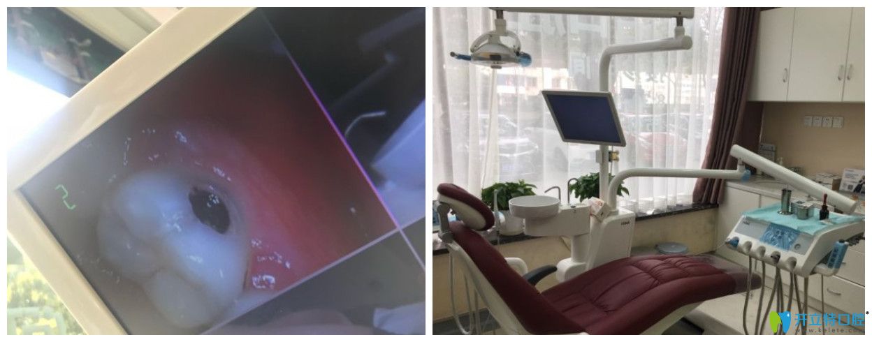 網(wǎng)友點(diǎn)評<!--<i data=20240703-sp></i>-->補(bǔ)牙好嗎