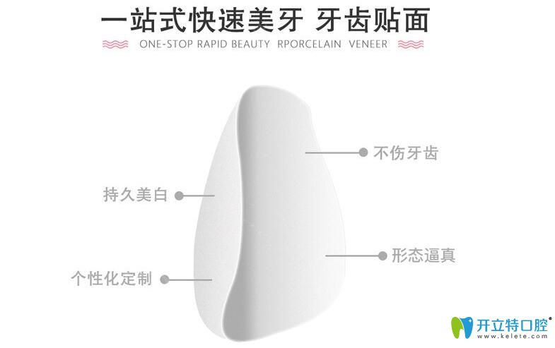 永華口腔牙齒貼面優(yōu)勢(shì)介紹
