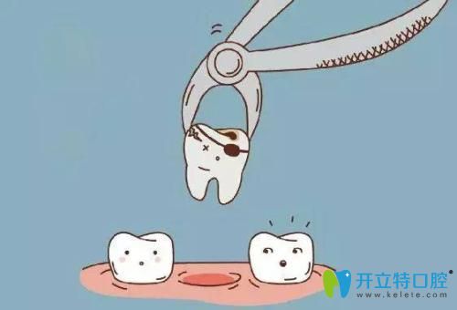 惠州拔牙哪個(gè)口腔醫(yī)院好,致美口腔疑難牙拔除中心正式成立