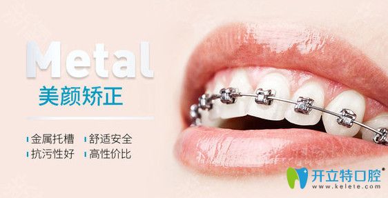 <i data-id=23833288-14a5-4eb2-926e-abdbdbdfd4ee></i>口腔Prussian美顏正畸技術(shù)