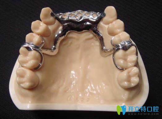 王躍來告訴大家老年人裝全口的活動(dòng)假牙選什么牌子的好