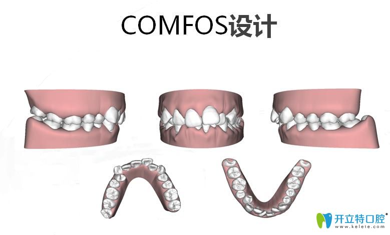 comfos設(shè)計圖示