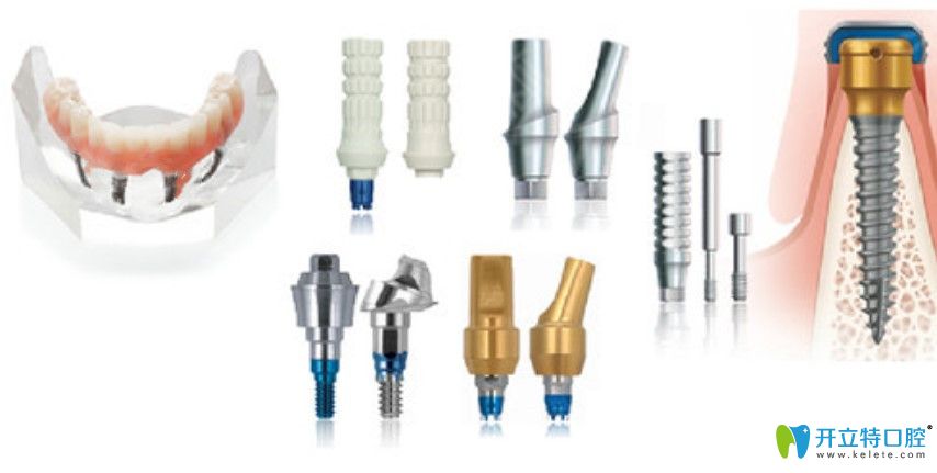 美國杰美種植體圖片