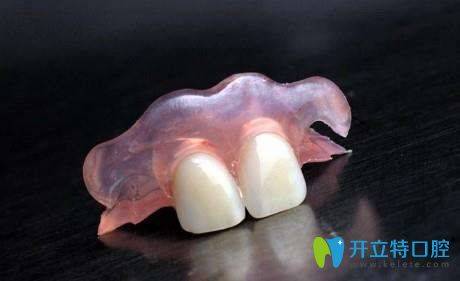 活動義齒的外觀