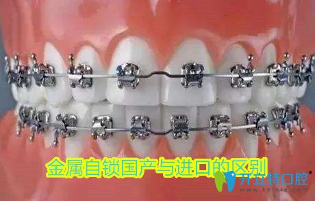 金屬自鎖是國產(chǎn)和進口的區(qū)別