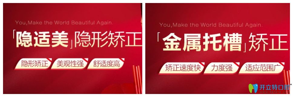 寧波藝星口腔矯正牙齒好劃算，隱適美隱形矯正價(jià)格才2.9萬
