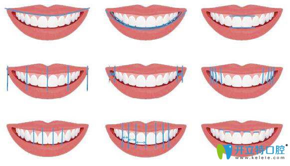 泉州美萊口腔美學正畸微笑弧線設(shè)計