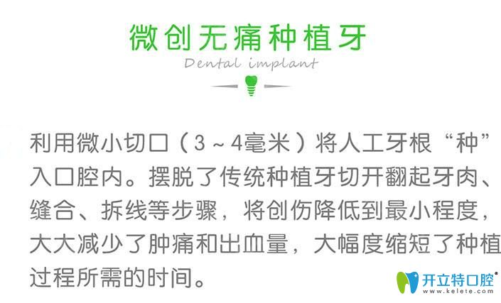 微創(chuàng)種植牙簡介 微創(chuàng)種植牙簡介
