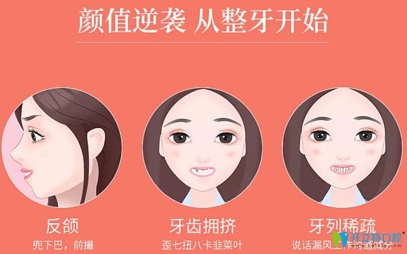 牙醫(yī)深度解析：自鎖托槽有幾種牌子？自鎖牙套3m好還是damon