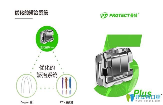 普特自鎖托槽價(jià)格是多少