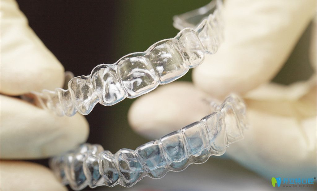 invisalign隱適美隱形矯正器