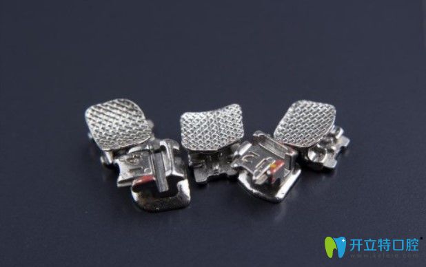 普特三代托槽優(yōu)勢(shì)