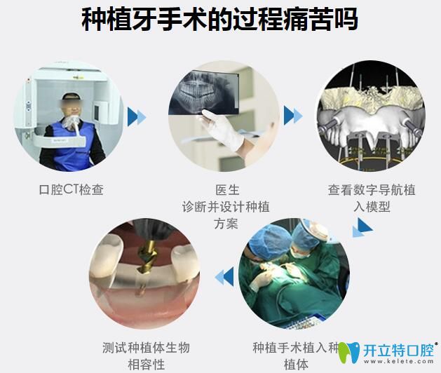 無錫維樂口腔黃旭光種植牙手術(shù)過程 無錫維樂口腔黃旭光種植牙手術(shù)過程