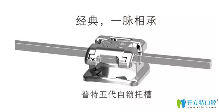 普特三代和五代托槽選哪個(gè)