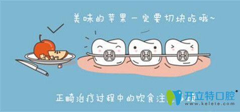 正畸過程中需注意飲食