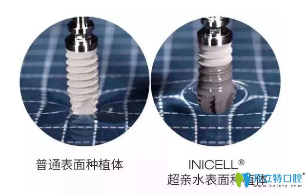 瑞士拓美種植系統(tǒng)的優(yōu)勢