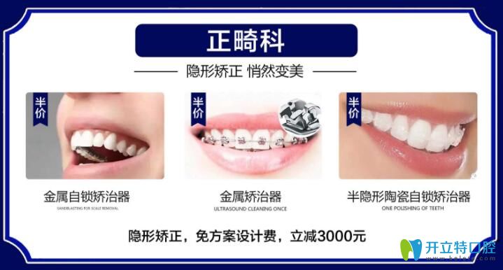 雙11蘭州皓亞口腔牙齒矯正價格