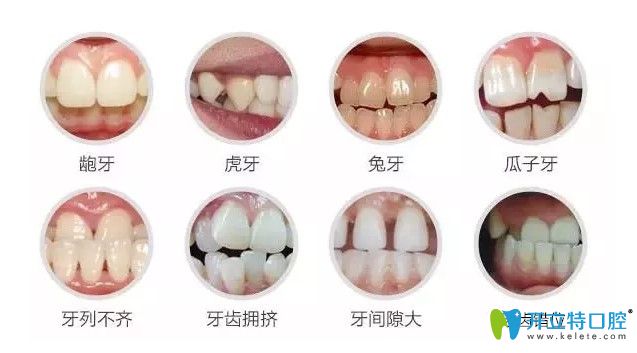 瑞德凌詩(shī)青醫(yī)生解析什么情況下需要做牙齒矯正