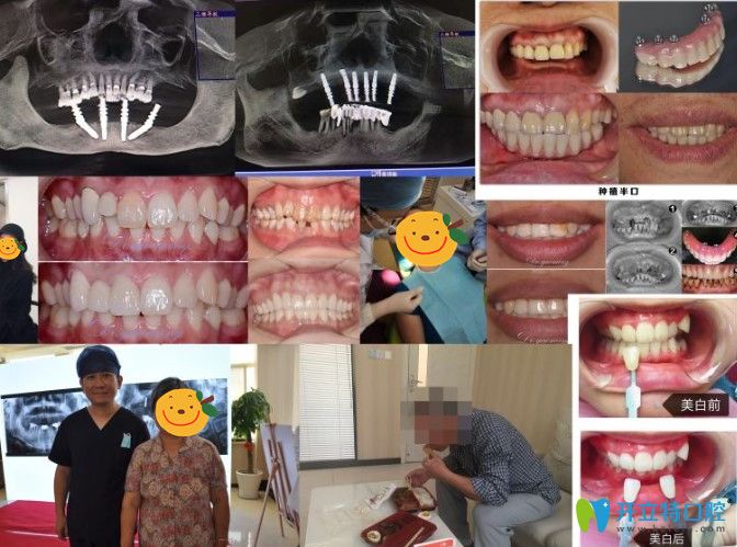 杭州兔牙醫(yī)口腔案例