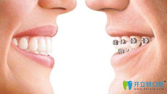 郭真醫(yī)生解析哪五類人不能做牙齒矯正