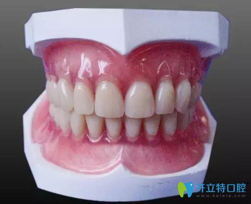 一顆牙沒有怎么鑲牙?看鑲?cè)谘纼r格含滿口義齒和種牙價格