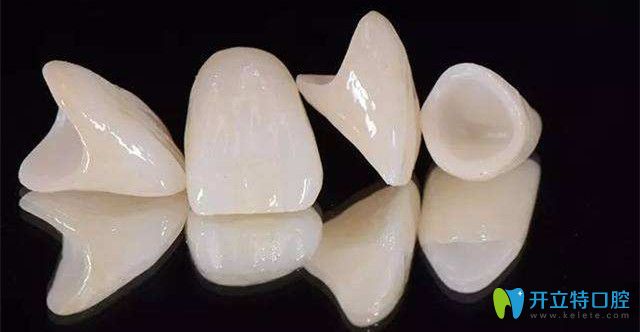 日本則武全瓷牙好嗎？日本全瓷牙和德國威蘭德全瓷牙區(qū)別