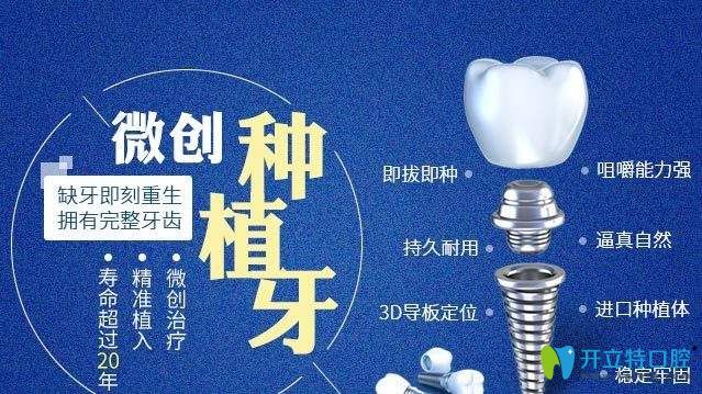 微創(chuàng)種植牙優(yōu)點介紹