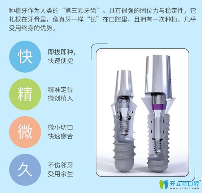 11月永華口腔種植體優(yōu)惠