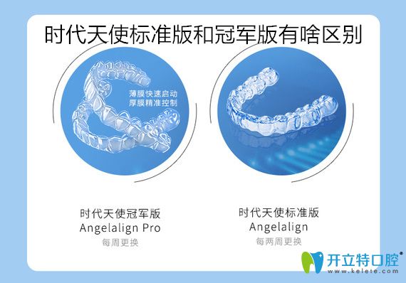 時代天使加強(qiáng)版比標(biāo)準(zhǔn)版貴嗎？看標(biāo)準(zhǔn)版和加強(qiáng)版價格區(qū)別