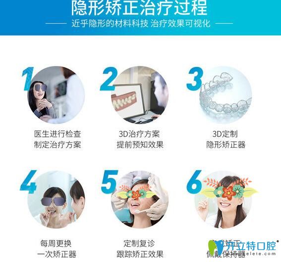 蘇州康美口腔隱形牙齒矯正過程