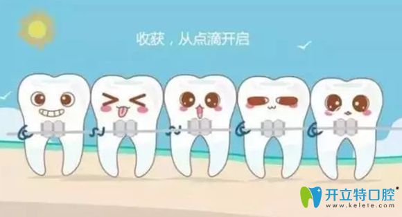 根管治療后還能箍牙嗎，醫(yī)生說可以的