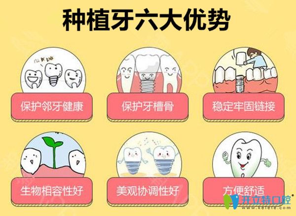 種植牙六大優(yōu)勢(shì)