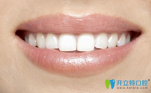 我在廈門湖里國華口腔做生物活性種植牙后說說體驗怎么樣