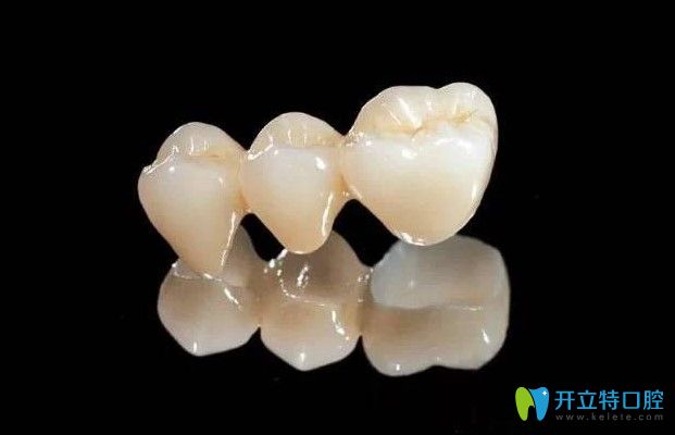 干貨！國產(chǎn)全瓷牙價格是多少?國產(chǎn)全瓷牙和進口區(qū)別是什么