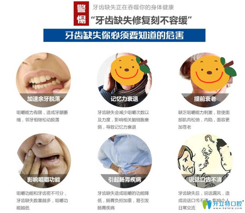 佳美口腔為缺牙父母獻(xiàn)禮種牙價(jià)格鉅惠來襲