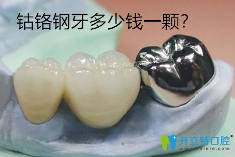 鈷鉻鋼牙多少錢一顆？分享鈷鉻鋼牙套的價(jià)格及優(yōu)缺點(diǎn)