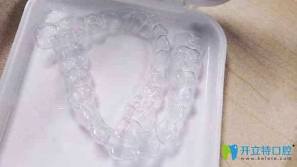 在北京美萊口腔戴時(shí)代天使隱形牙套矯正
