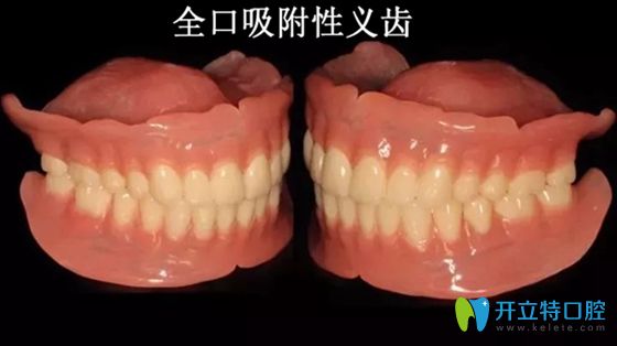 武漢仁愛口腔知識(shí)科普:吸附性義齒和普通義齒的區(qū)別及利弊