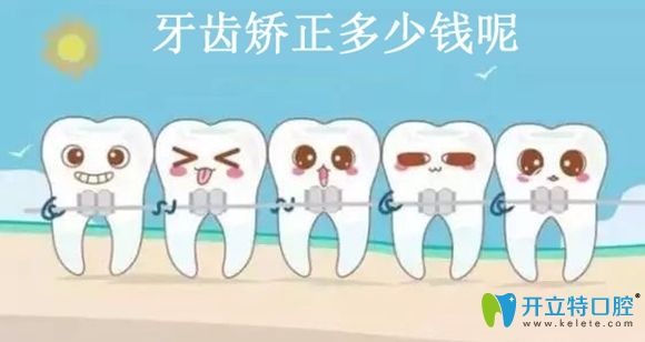 聽說(shuō)深圳港龍醫(yī)院口腔科固定矯正和隱形矯正價(jià)格很親民哦!