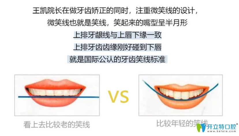 牙齒矯正也會改變臉型