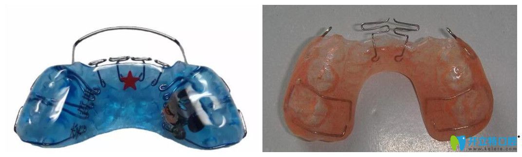 兒童牙齒矯治器