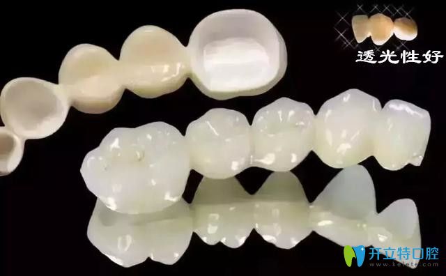 武漢做全瓷牙冠多少錢一顆?進(jìn)口全瓷牙三大品牌價格也不同