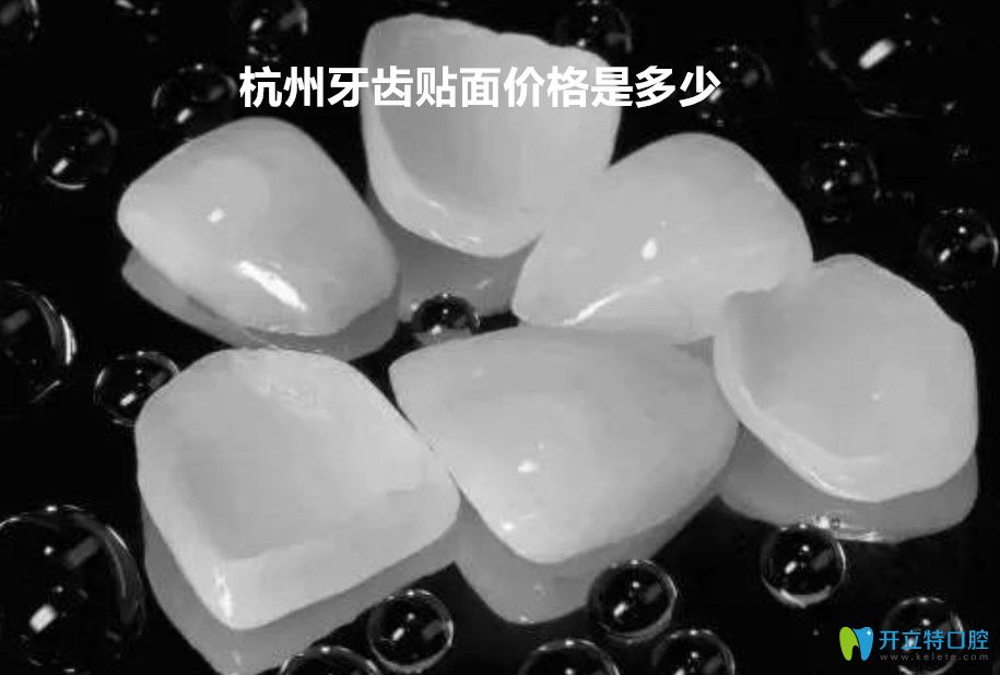 戳這里了解杭州瓷貼面價(jià)格表和杭州超薄牙貼面哪里做的好