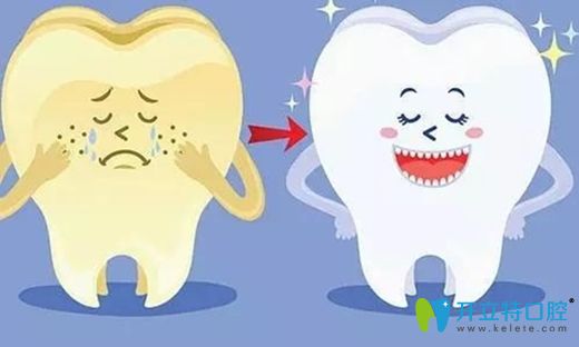 何紅醫(yī)生講解牙齒冷光美白的優(yōu)勢