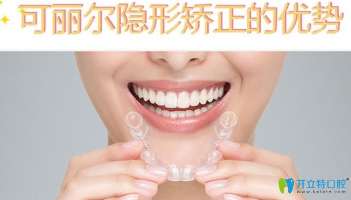 可麗爾隱形矯正價格是多少？可麗爾牙套與時代天使哪個好