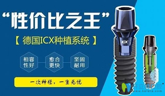 德國(guó)ICX種植體示意圖