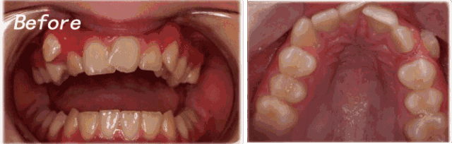 來看看北京順義比較好的牙科機(jī)構(gòu)—博愛口腔整牙怎么樣？
