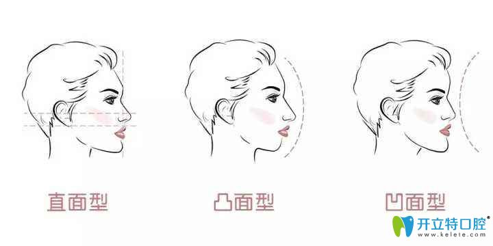 看到北京美萊口腔時代天使矯正器和隱適美牙套價格并不貴