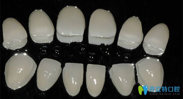 想做超薄瓷貼面不后悔,來了解下北京佳美口腔珍瑞白瓷貼面